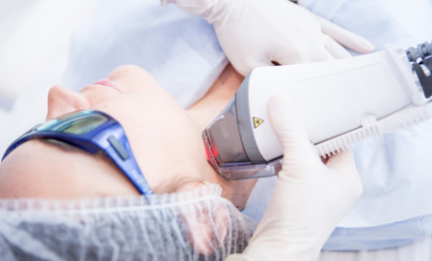 準(zhǔn)分子激光